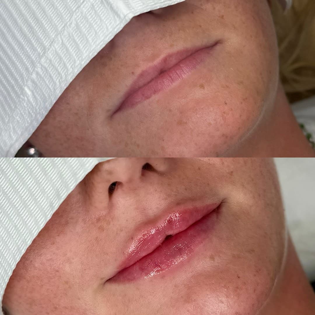 Bellissima Beauty & Aesthetics Ltd - Skin & Laser Clinic Surrey